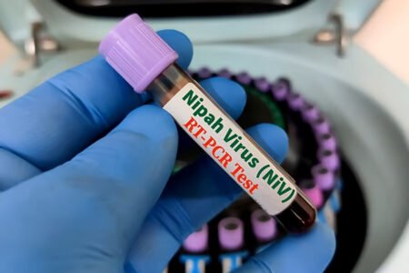 Asian Airports on High Alert -Tighten Health Screenings After Nipah Virus Outbreak in India